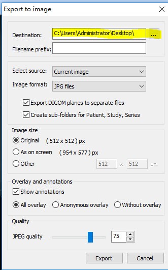 MicroDicom viewer