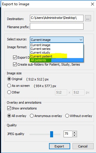 MicroDicom viewer