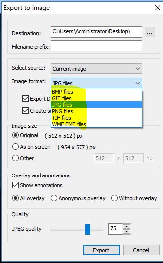 MicroDicom viewer