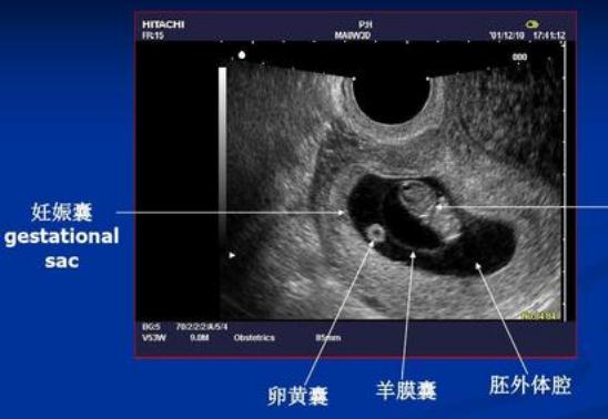 农历八月十五受孕什么时候生，2022年必定生女孩月份