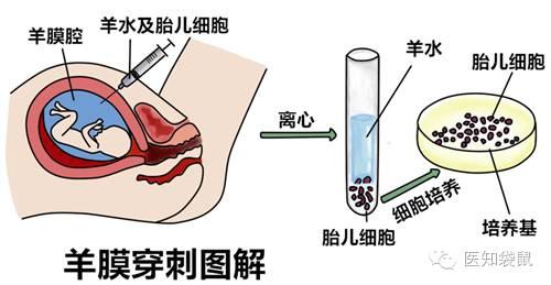 准确率100的生男生女公式，九个最准怀男孩征兆