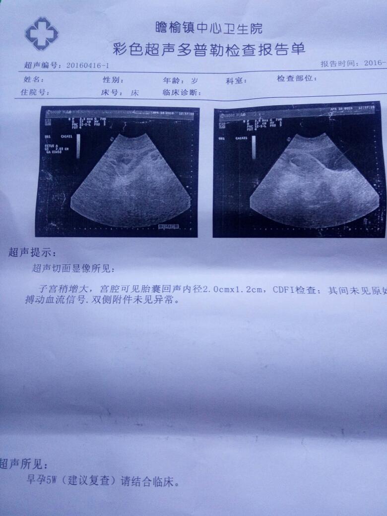 一周内怀孕有什么症状，怀孕最初几天什么感觉