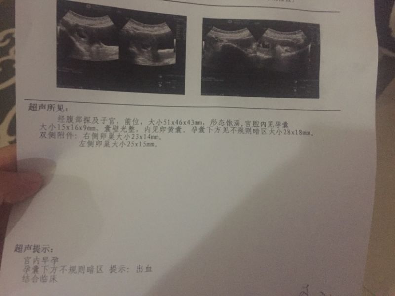 一周内怀孕有什么症状，怀孕最初几天什么感觉