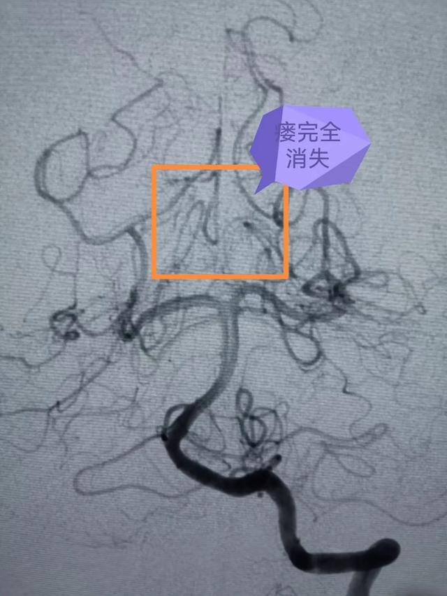 7岁开始转运，带上转运珠发表说说"