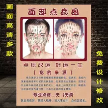 4、女人面部痣相图解 哪些是幸运痣