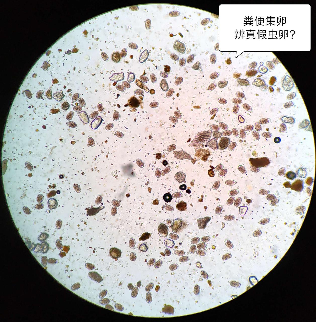 2、清肠便排完还能抢救活下来吗？