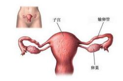 引起子宫畸形的原因 月经异常当心 双子宫